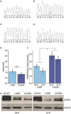 Functional Characterization of Novel ATP7B Variants for Diagnosis of Wilson Disease